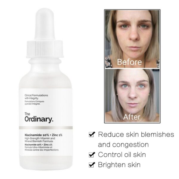 Ordinary Niacinamide 10% + Zinc 1% Serum - Image 3